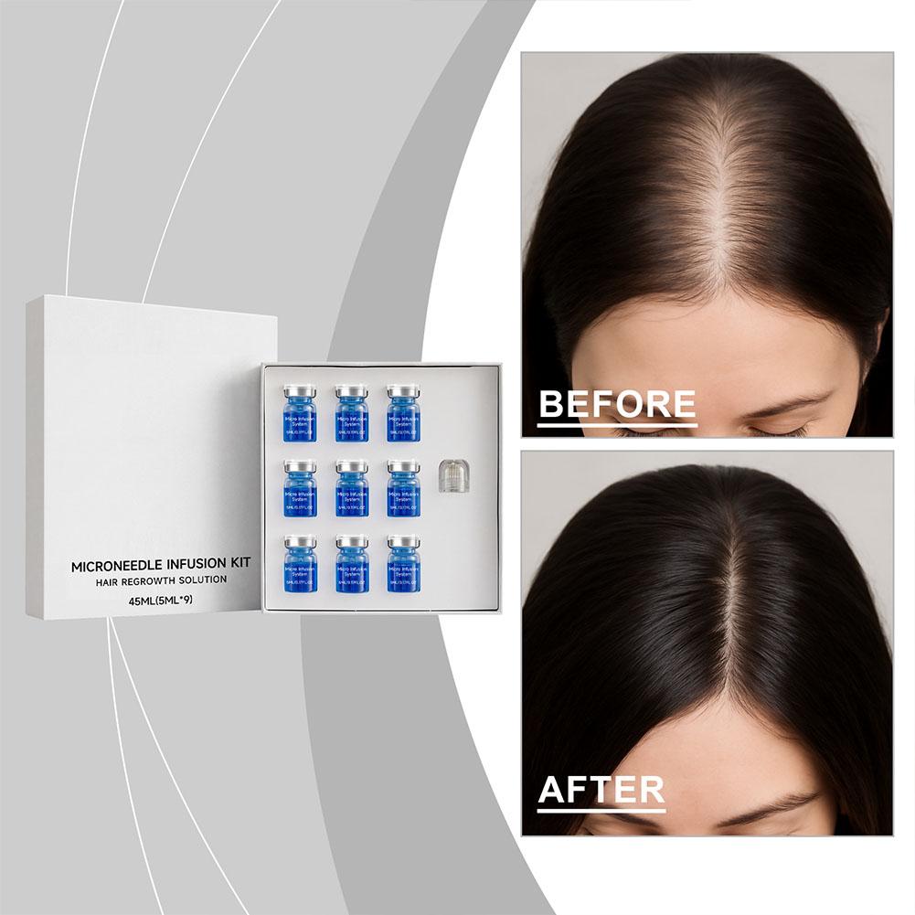 Hair Care Kit - 0,25mm Haar-Essenz-Serum Mikronadel-Roller-Set Haarfollikel-Nährendes Kopfhautpflege-Set Haarverdichtungs-Conditioner