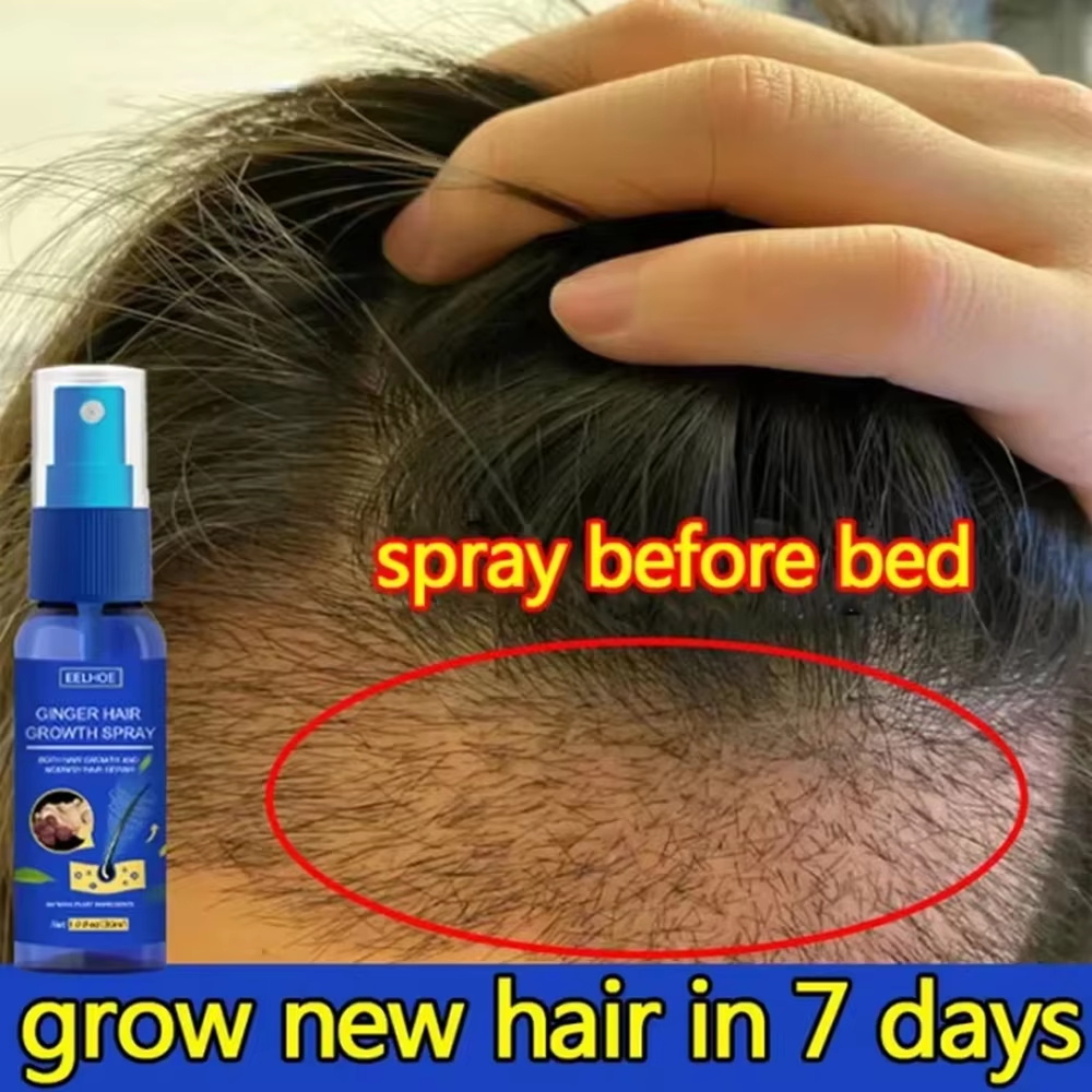 Hair Growth Serum Oil - Schnelles Ingwer-Haarwuchsspray für Wurzelwachstum, Anti-Haarausfall, Haarwuchs-Serum,